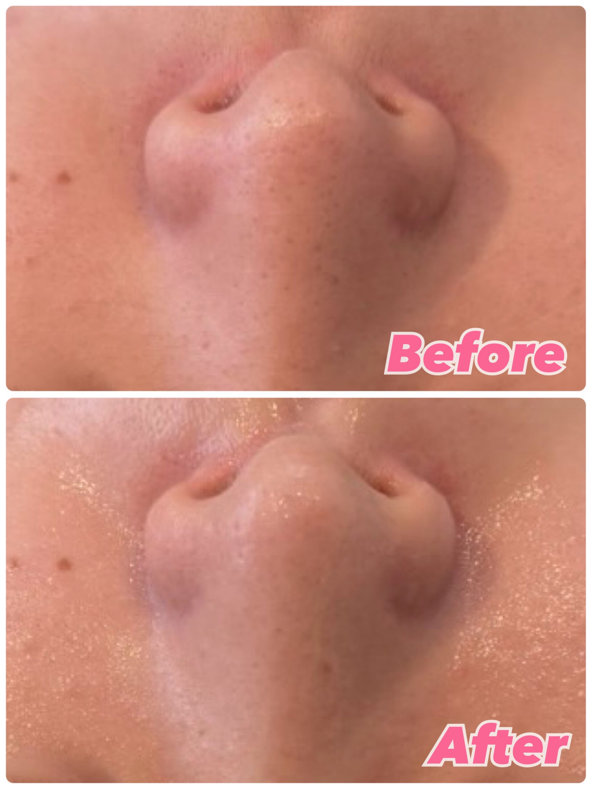 ☆大幅値下げ☆　bijou　毛穴洗浄 ☆大幅値下げ☆ bijou 毛穴洗浄