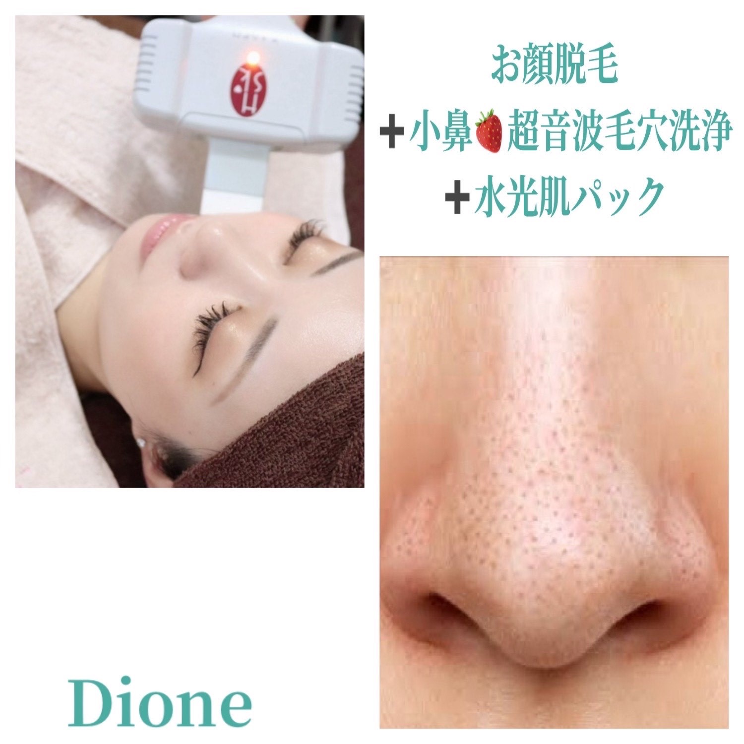いちご鼻撃退！！！ | 敏感肌も美肌になる痛くない脱毛【Dione